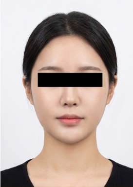 이전 의료기관 비대칭 기록 3 치료 후
