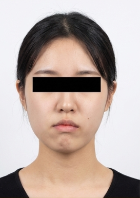 이전 의료기관 비대칭 기록 3 치료 전