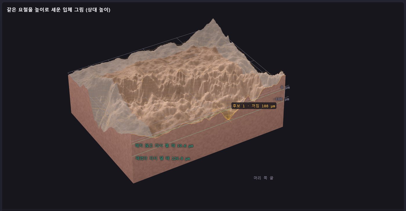 턱 · 우측 하악부위 · 02 · 같은 자리의 3D 표면