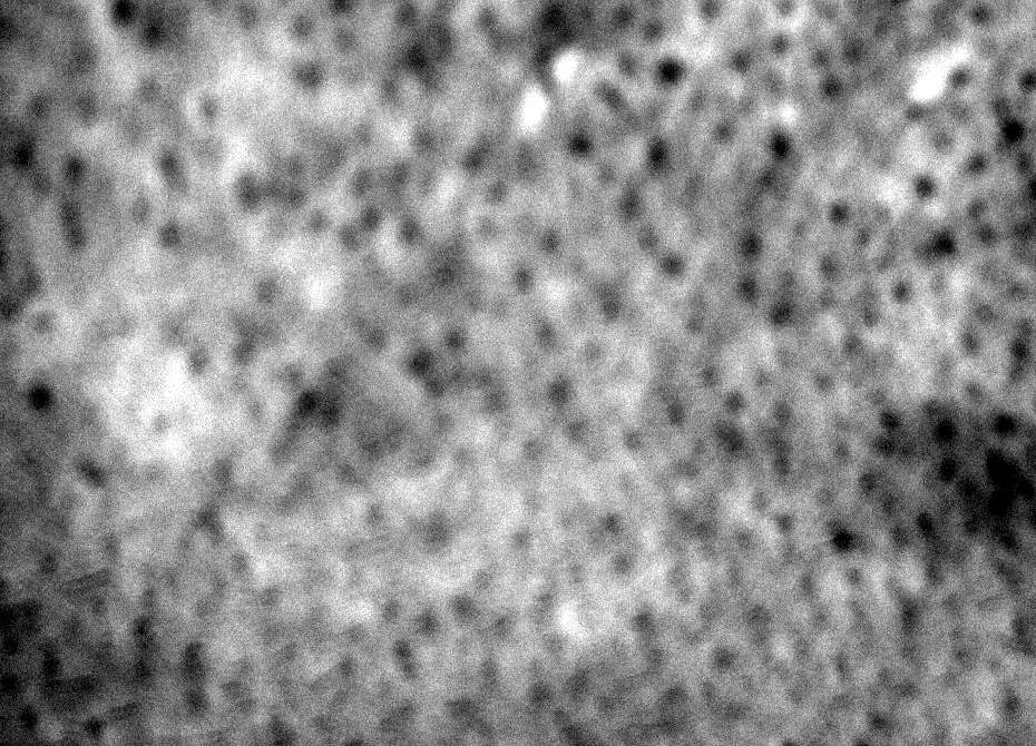 Actual monochrome capture of the 29.4 × 21.2 mm window by the scar measurement device camera