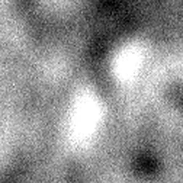 The surface around candidate 1, enlarged to 4 mm